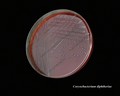 corynebacterium diphtheriae
